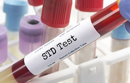 STD Testing at Hisential