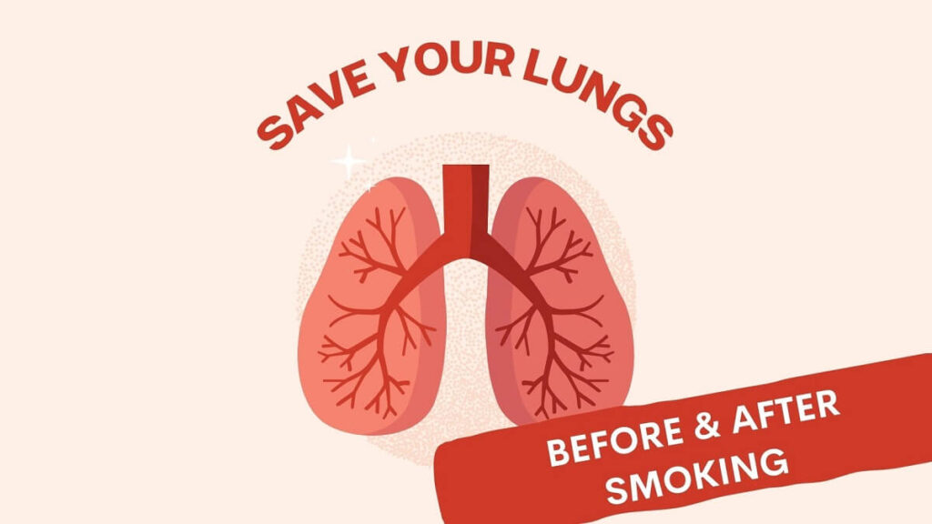 Save your Lungs